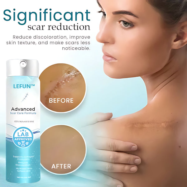 Advanced 💧LEFUN™ Scar spray For All Types of Scars -For example Acne Scars,Surgical Scars andStretch Marks