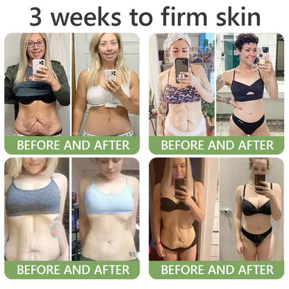 (Made and Shipped from USA) 🔥𝗟𝗲𝗻𝗮𝗿𝗼® 𝗕𝗲𝗲 𝗩𝗲𝗻𝗼𝗺 𝗔𝗻𝘁𝗶-𝗪𝗿𝗶𝗻𝗸𝗹𝗲 𝗖𝗿𝗲𝗮𝗺 - 🎉LAST DAY 80% OFF