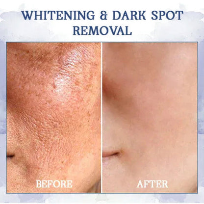 ☘️💧𝐋𝐚𝐬𝐭 𝐃𝐚𝐲 𝐃𝐢𝐬𝐜𝐨𝐮𝐧𝐭: 80% 𝐎𝐅𝐅🫧𝐅𝐮𝐛𝐬𝐭𝐚® Advanced Firming & Wrinkle-Reducing Cream: Restore Skin Elasticity🌐