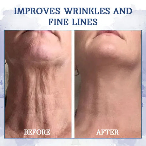 ⭐💧𝐋𝐚𝐬𝐭 𝐃𝐚𝐲 𝐃𝐢𝐬𝐜𝐨𝐮𝐧𝐭: 80% 𝐎𝐅𝐅🫧𝐅𝐮𝐛𝐬𝐭𝐚® Advanced Firming & Wrinkle-Reducing Cream: Restore Skin Elasticity