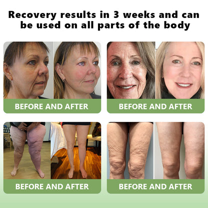 Lenaro® Advanced Skin Restoring Botox Bee Venom Therapy Cream✅Time-limited discount