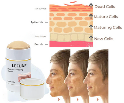 ⭐Last Day Sale-80% OFF) - LEFUN® Melanin Correcting Cream