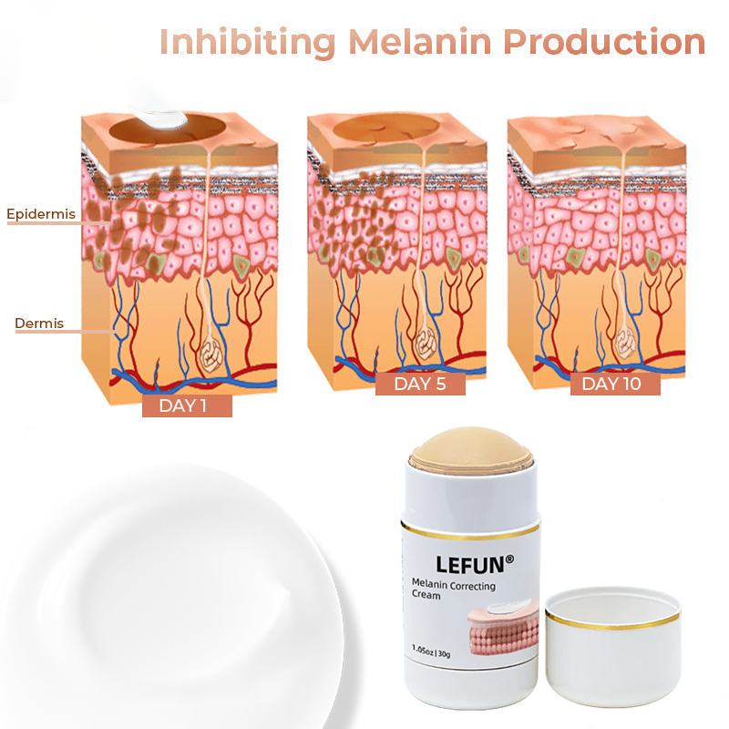 🔥Last Day Sale-80% OFF) - LEFUN® Melanin Correcting Cream