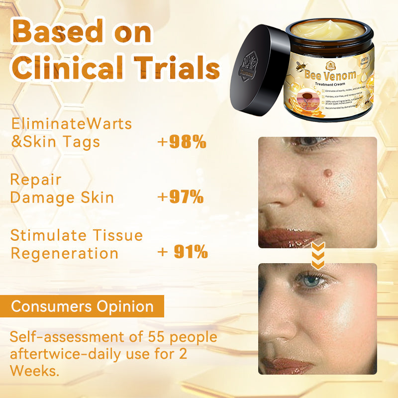 Turonu™ Bee Venom Skin Treatment Cream🐝（𝐴𝐴𝐷 𝑅𝑒𝑐𝑜𝑚𝑚𝑒𝑛𝑑𝑒𝑑） (🔥Last day promotion 80% off)