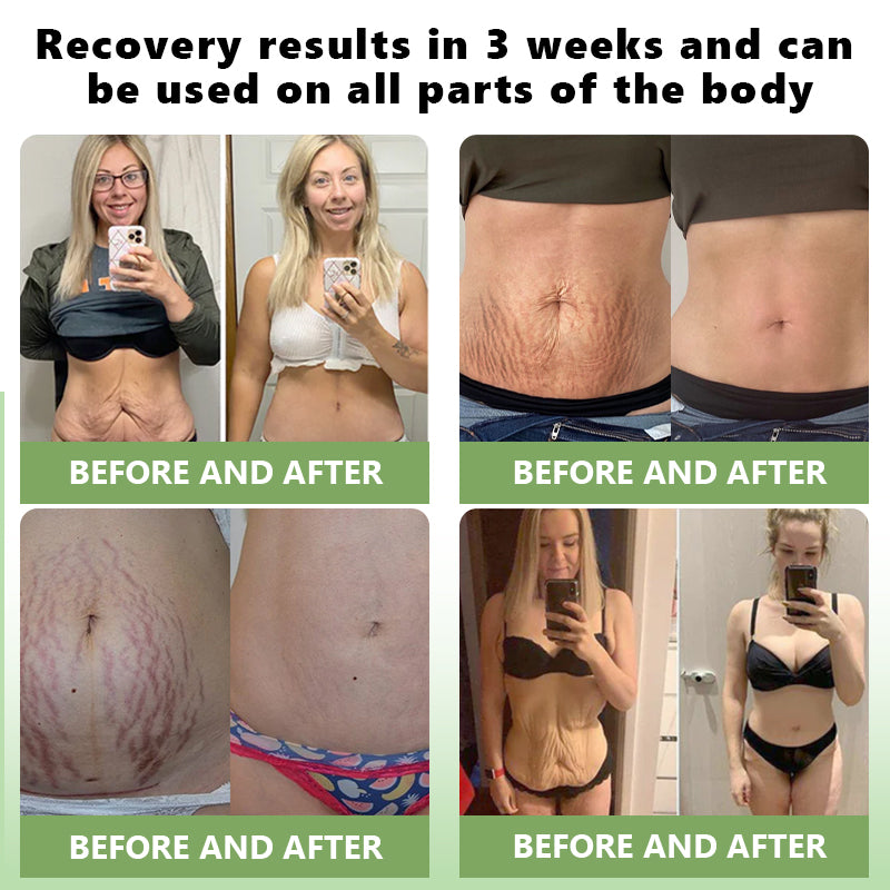 Lenaro® Advanced Skin Restoring Botox Bee Venom Therapy Cream✅Time-limited discount