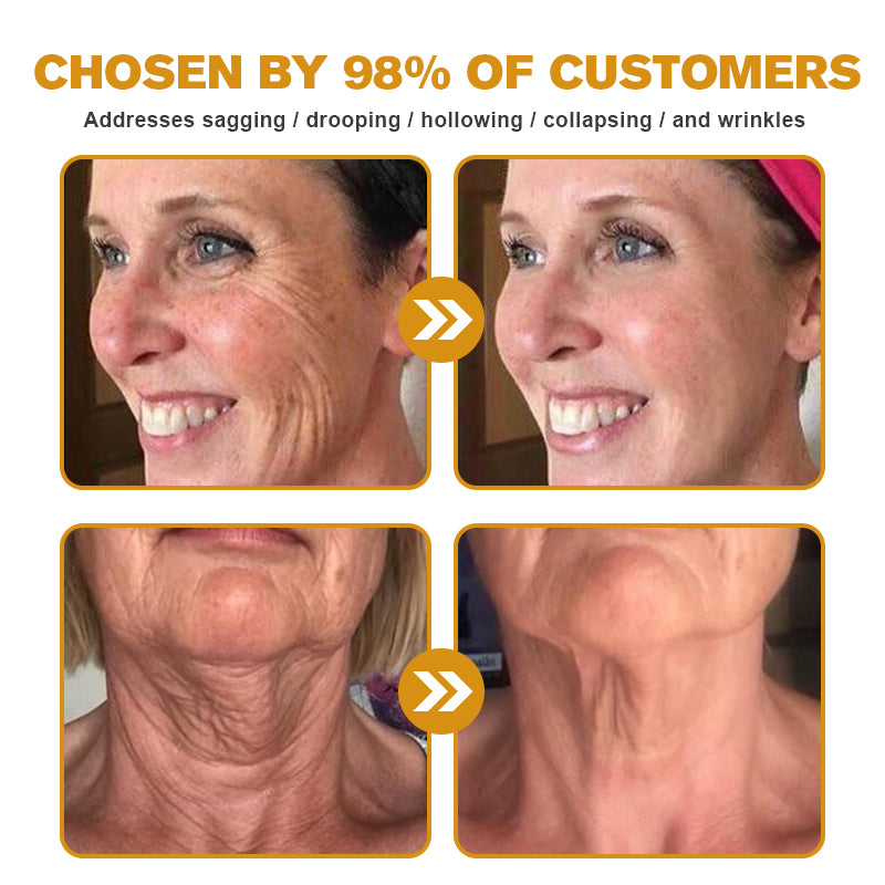 Lenaro® Advanced Skin Restoring Botox Bee Venom Therapy Cream✅Time-limited discount