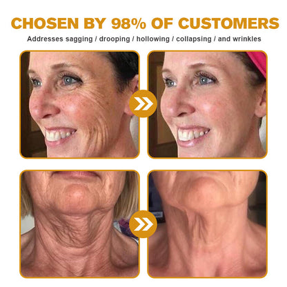 Lenaro® Advanced Skin Restoring Botox Bee Venom Therapy Cream✅Time-limited discount