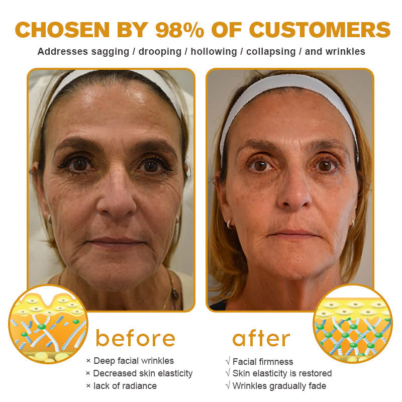 Lenaro® Advanced Skin Restoring Botox Bee Venom Therapy Cream✅Time-limited discount