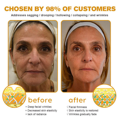 Lenaro® Advanced Skin Restoring Botox Bee Venom Therapy Cream✅Time-limited discount