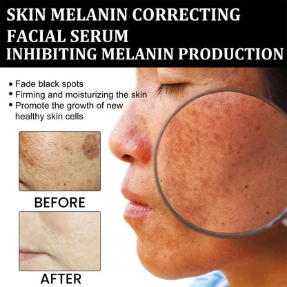 🌟Last Day Sale-80% OFF) - 🌟LEFUN® Melanin Correcting Cream